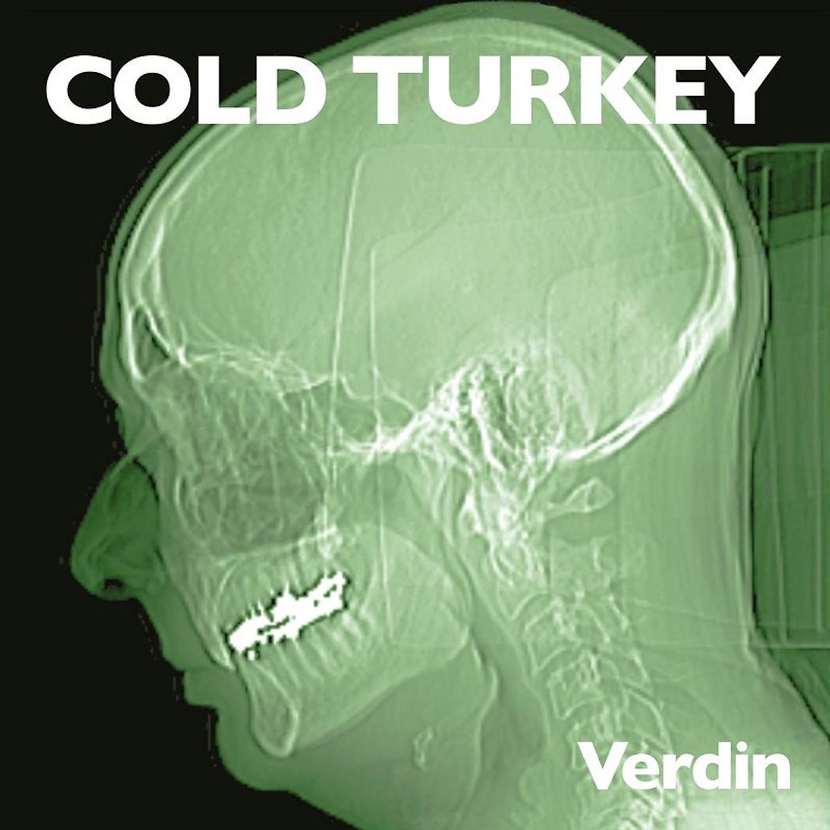 Lennon-covers Verdin op vinyl